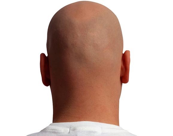 脫發年輕化，你中招了嗎？