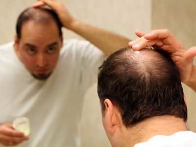 科學家提取“脫發克星” 可根治脫發 脫發怎么辦？