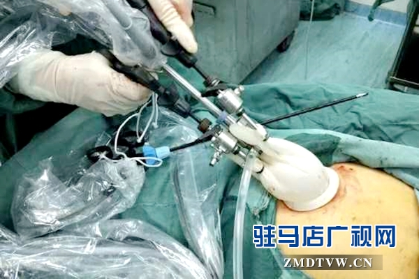 泌陽縣人民醫院成功完成首例單孔腹腔鏡手術