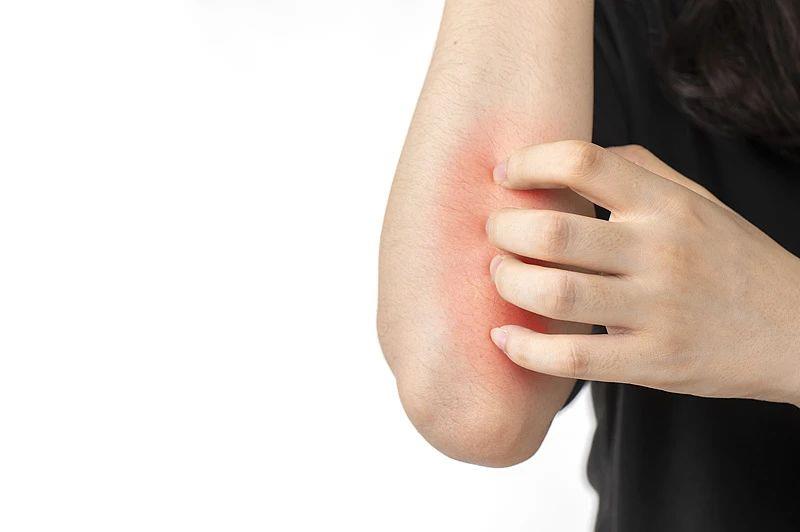 本周日入伏！“冬病夏治”的“三伏貼”適合你嗎？貼敷建議來了→