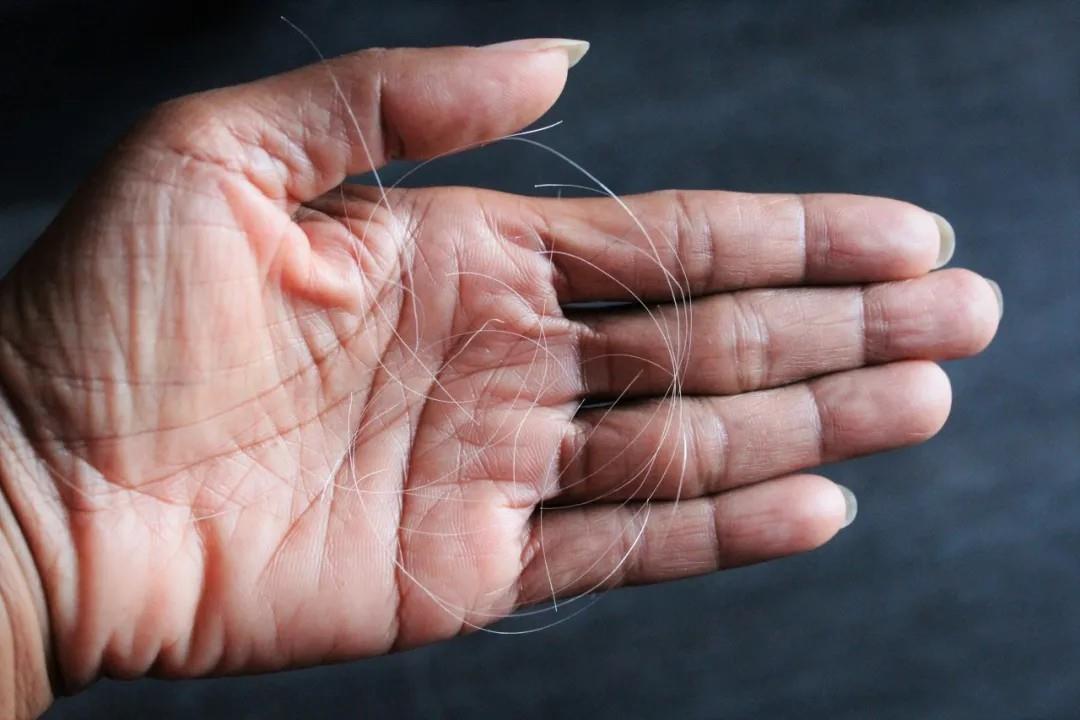 白頭發拔一根長三根？到底能不能拔？終于弄清楚了