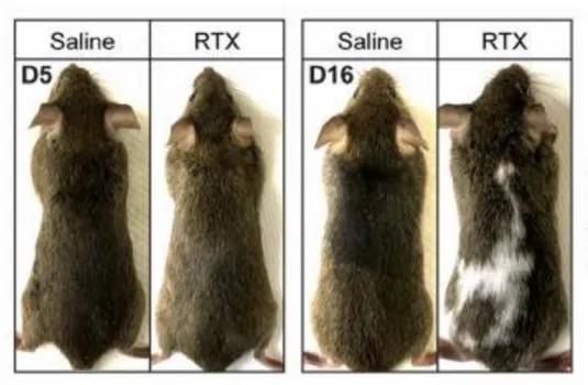 白頭發拔一根長三根？到底能不能拔？終于弄清楚了
