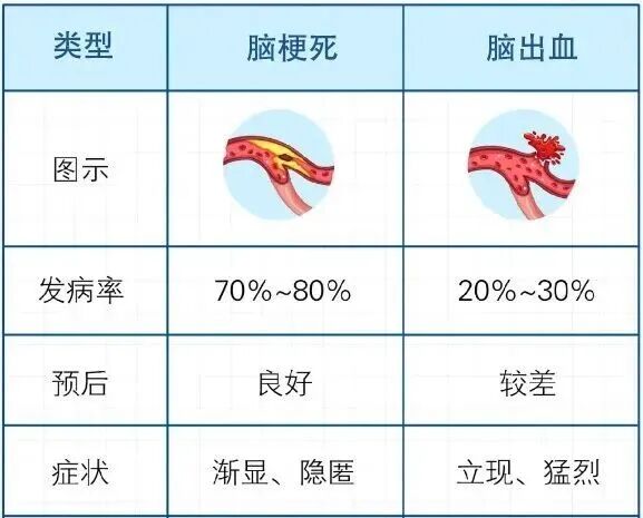 腦梗高發季到了！有3種不舒服，千萬別大意