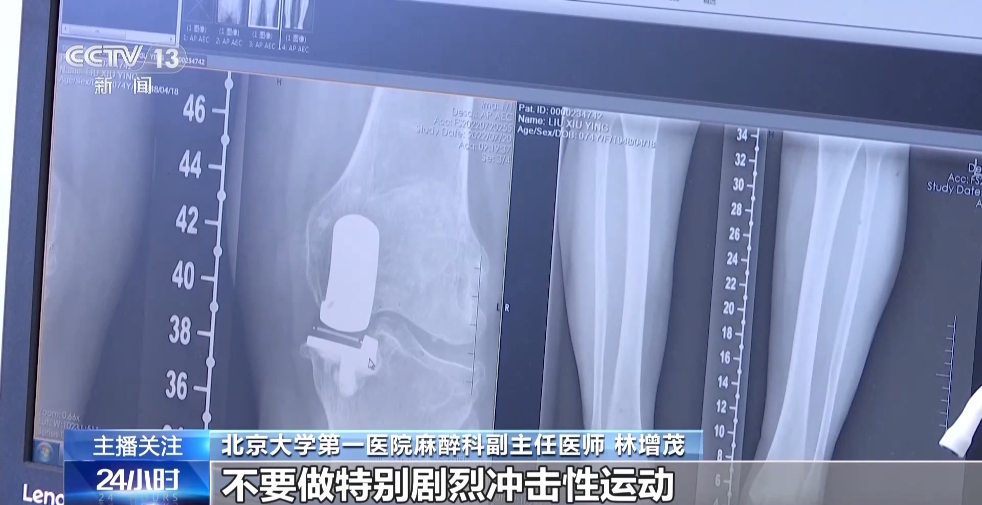 老年人遇到這些身體疼痛勿硬扛 或是健康重要預警信號